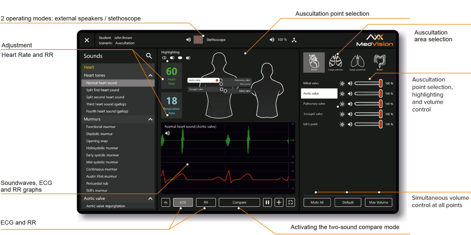MATT auscultation software