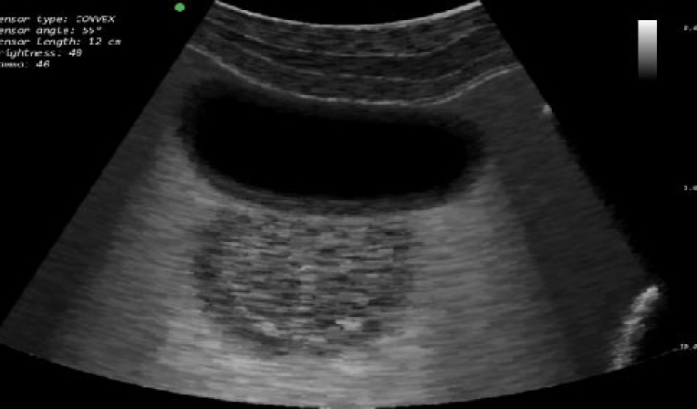 Urinary bladder and prostate ultrasound scanning skills training module (male anatomy) with abdominal transducer