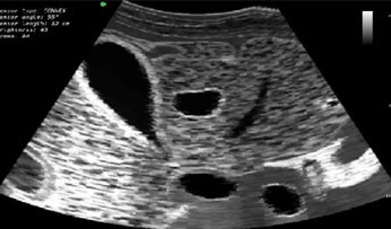 Ultrasound study module for abdominal organs and retroperitoneal space