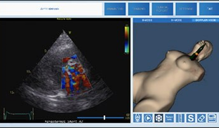 Transthoracic Echocardiography (TEE) based on data from real patients training module