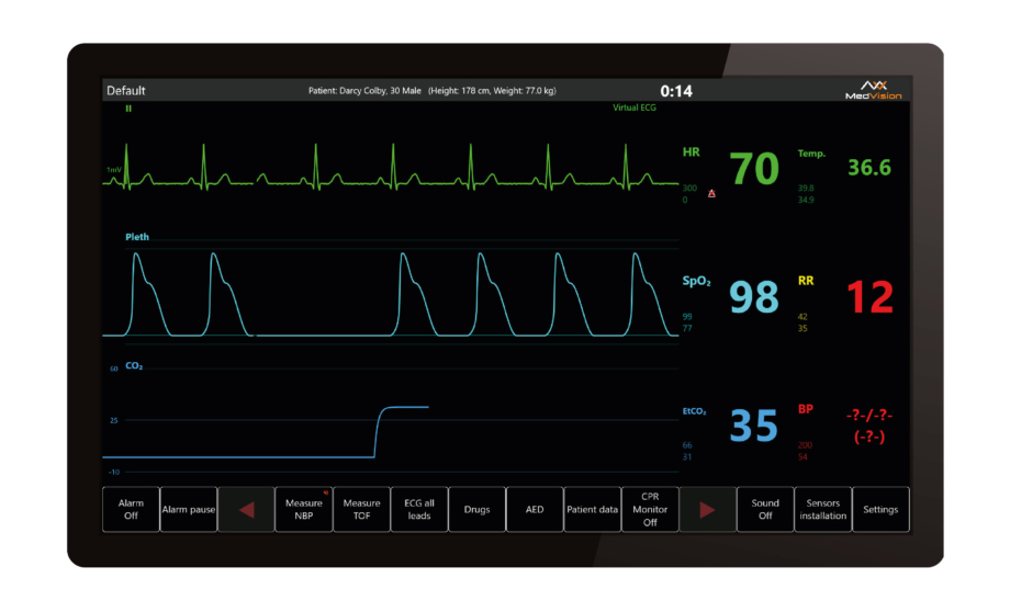 Leonardo Patient Monitor Software
